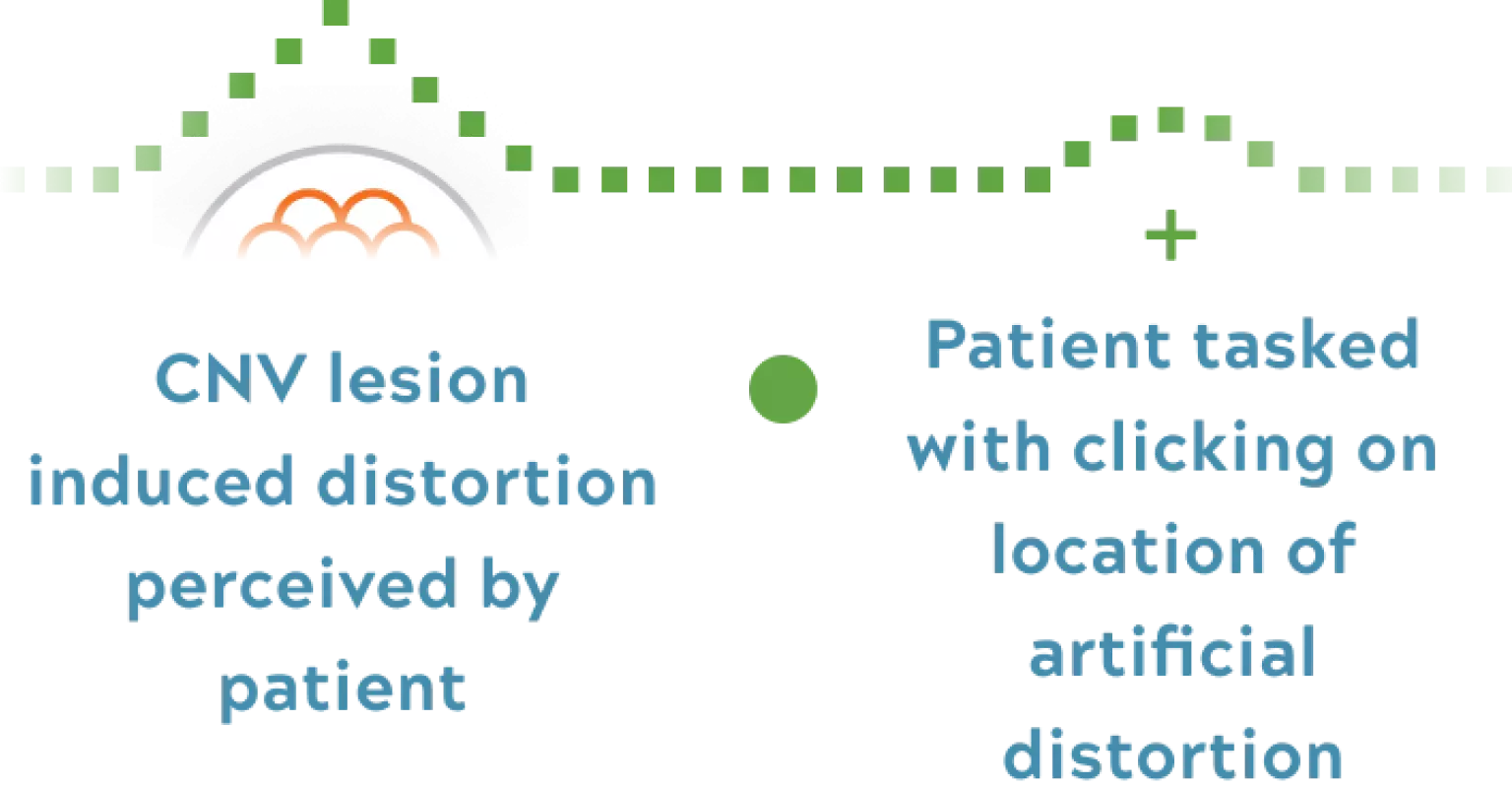 Testing cnv lesion induced distortion illustration mobile