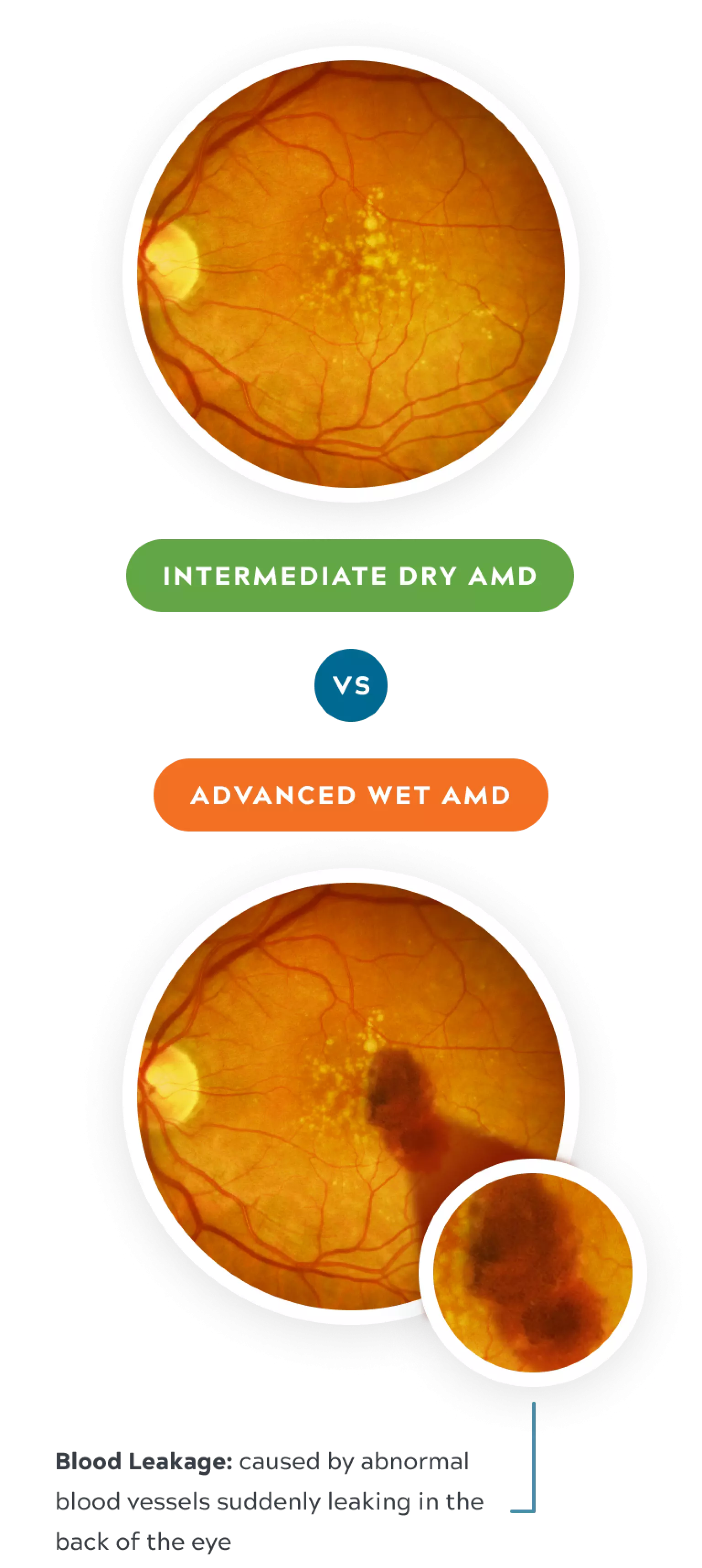 Intermediate vs advanced amd mobile