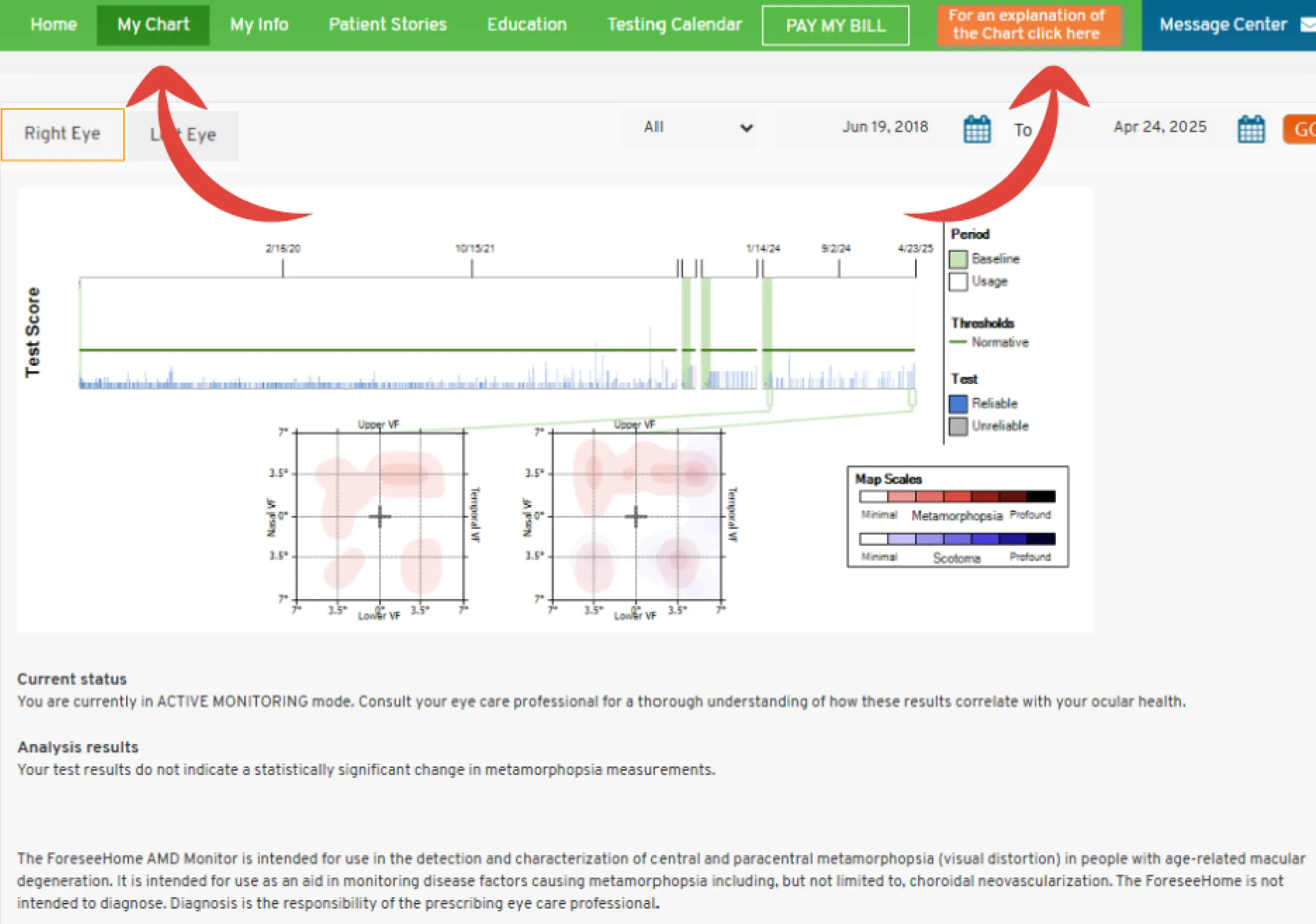 My Chart screen shot